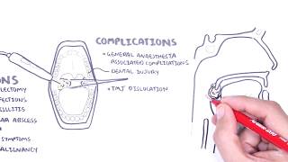 When Should You Remove Your Tonsils  The Doctors [upl. by Leith]