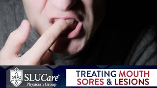 Mouth Sores amp Lesions Diagnosing and Treatment  SLUCare Otolaryngology [upl. by Aihsemek]