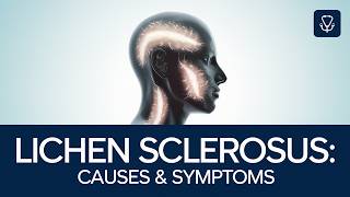 Understanding Lichen Sclerosus [upl. by Abott86]